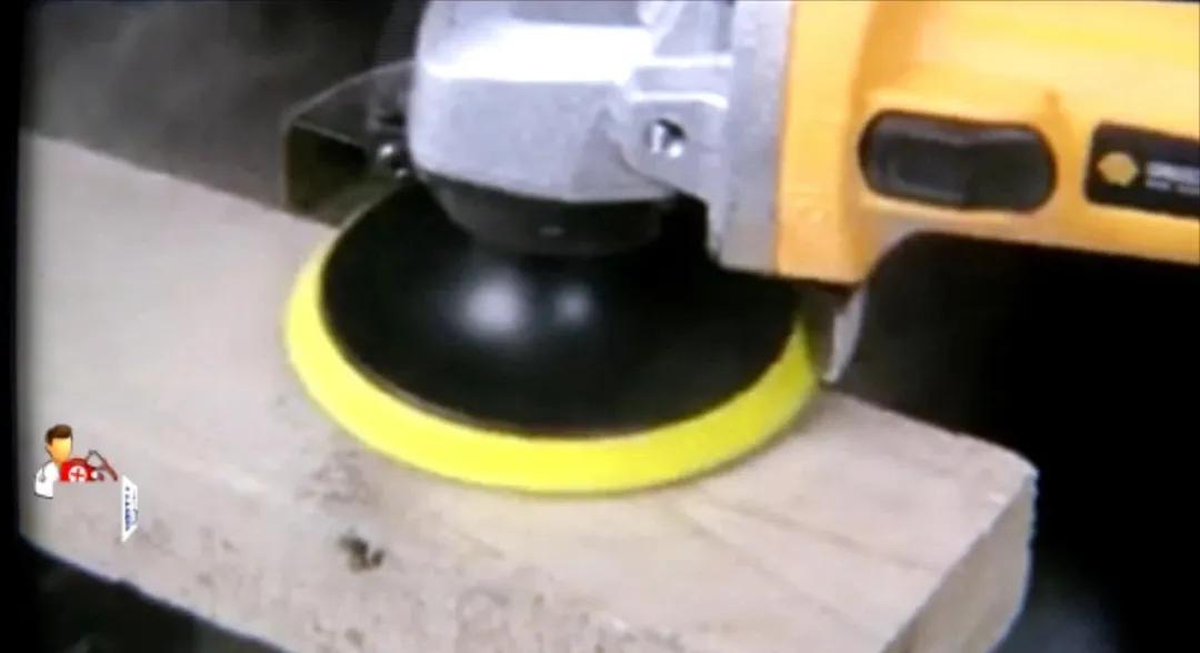 男子被角磨机割伤后活了下来,男子操作绞肉机不慎被咬手