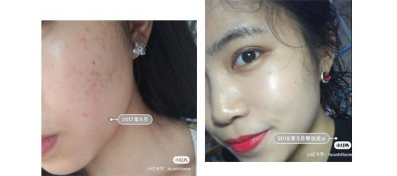 欧莱雅算不算欺诈消费,欧莱雅虚假宣传罚款多少