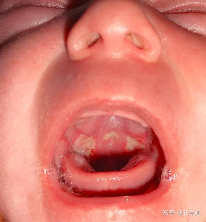 喂奶方式不正确宝宝会呛奶吗,喂奶方法不对会肠胀气吗