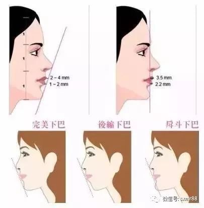 好看的下巴是什么样的,什么样的下巴好看