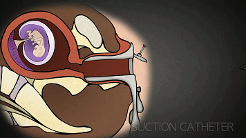 男人爱不爱你看他肯不肯为你花钱,产房可以看出男人爱不爱你