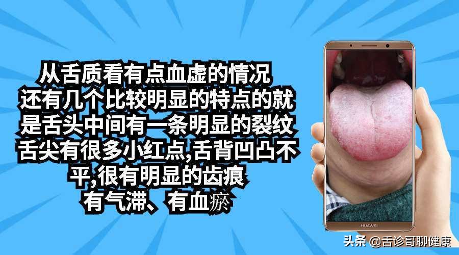 肺结核头晕头痛胸口闷是正常吗,肺结核治疗期头晕是什么原因