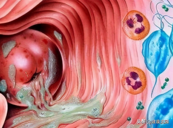 健康科普堂|秋冬已到，莫要“捂”出病