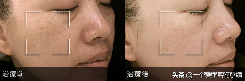 日本女孩长不胖的秘密,日本女人为何不长斑