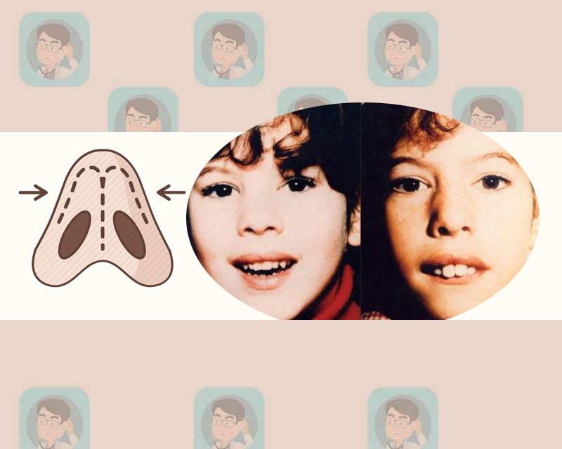 人体脏的三个地方,人体3个部位的脏东西别过度清洗