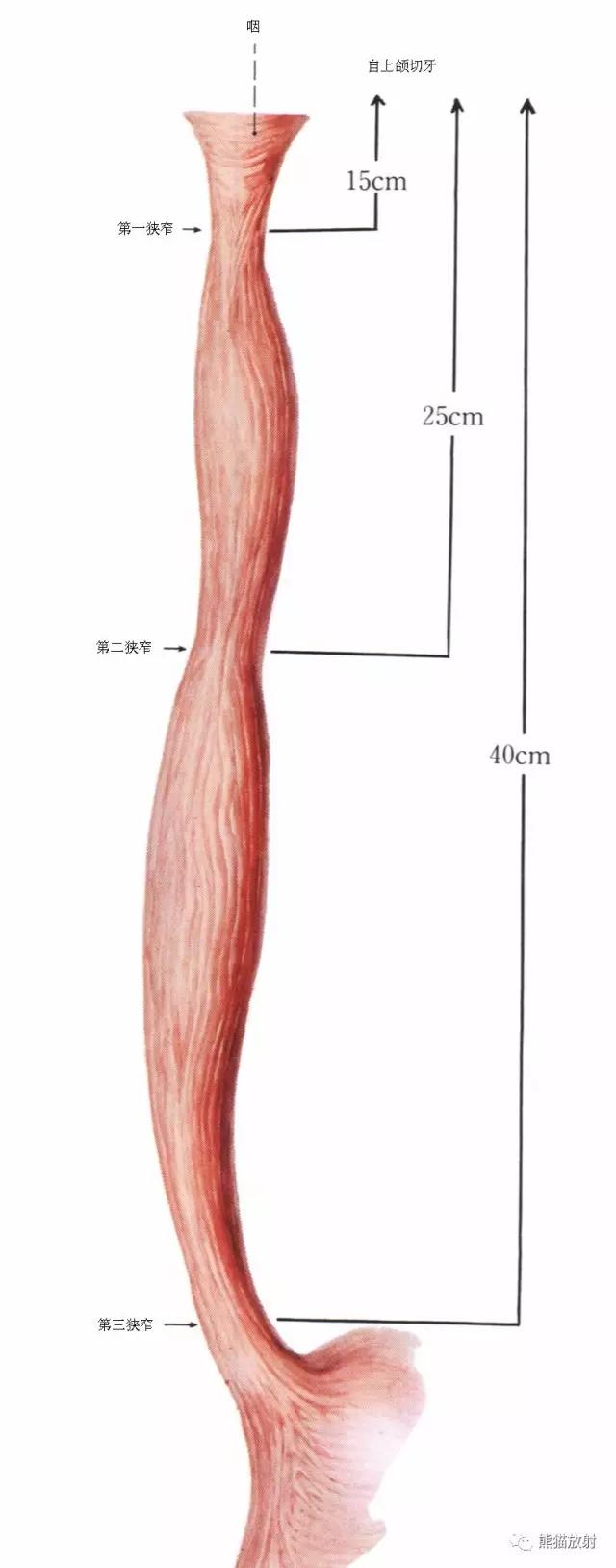 详细的消化道造影+彩色解剖图
