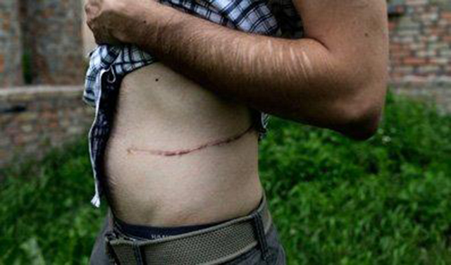 尼泊尔肾谷村落,尼泊尔肾谷现状