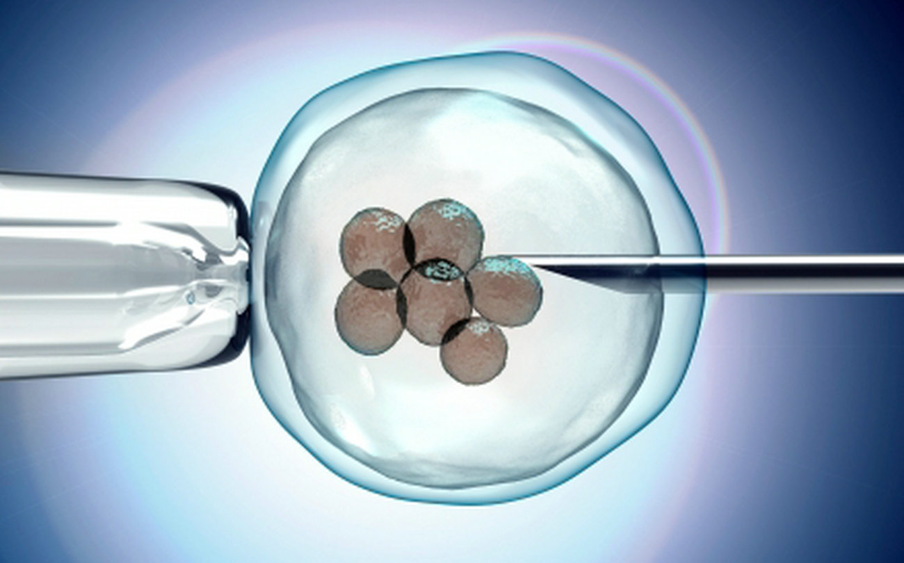 科学家研究精子运动过程，视频显示行动缓慢的毫不留情被淘汰了