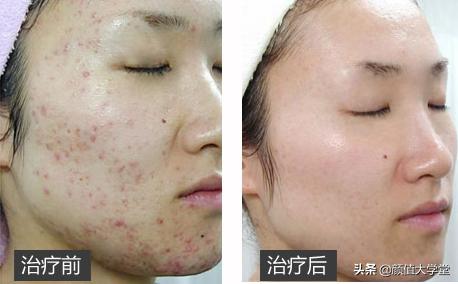 运动可以让脸上皮肤变好吗,脸上敷什么可以让皮肤变好