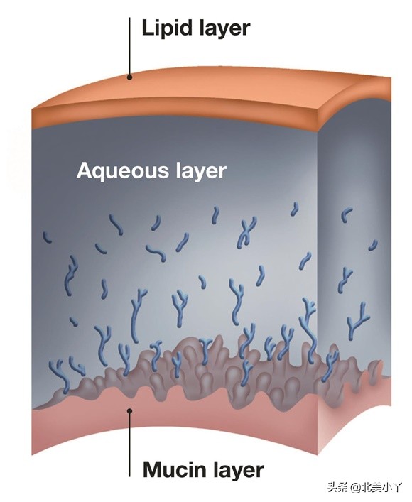 眼科医生3个忠告缓解干眼症,干眼症怎么解决眼科专家来告诉你