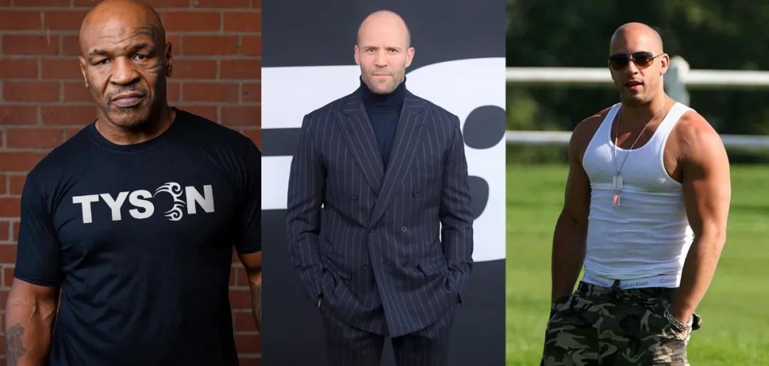 威廉王子秃顶了哈里为啥没秃顶,威廉王子为什么喜欢秃顶