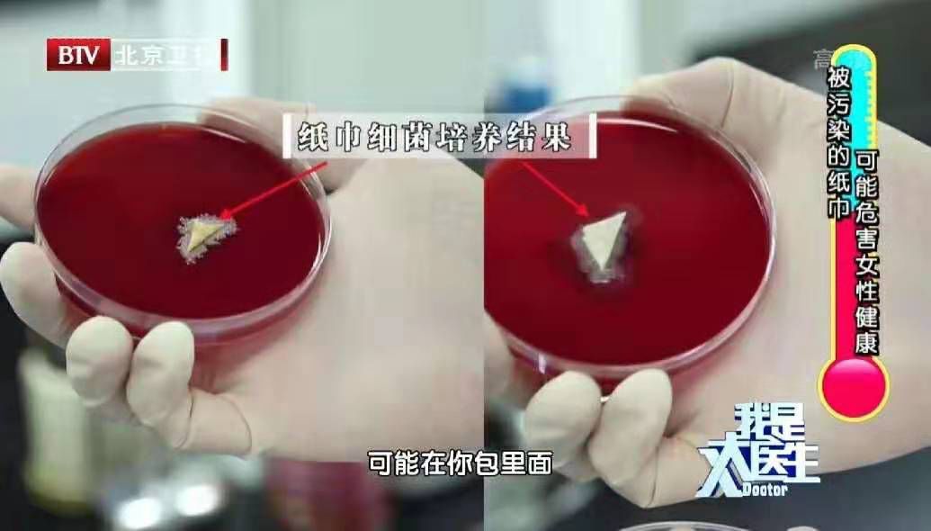 *生活性**后还在用纸巾「打扫战场」？看看医生是怎么说的