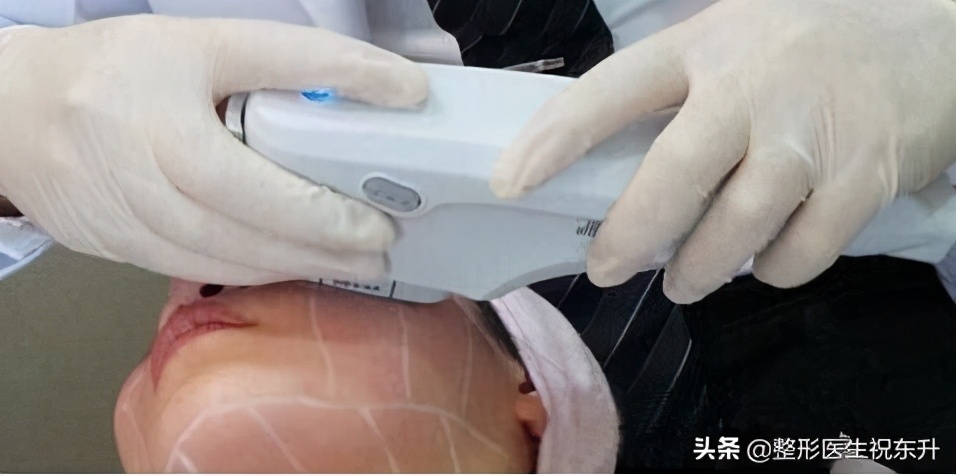 法令纹用什么方法去除效果好,去除法令纹的最有效的方法有哪些