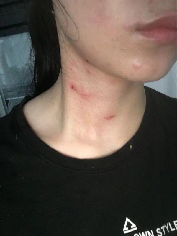 百香果的威力有多强,百香果果酱爆炸威力