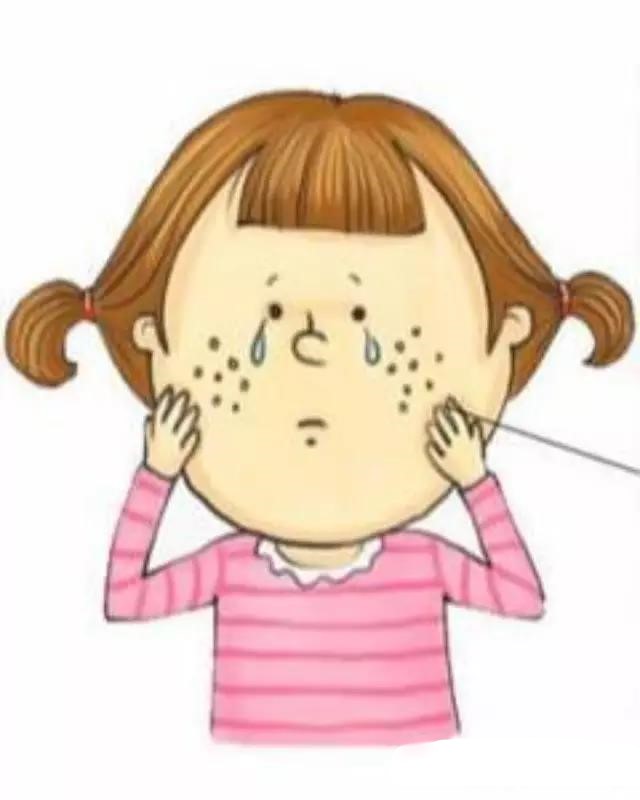 痘坑可以通过护肤手段平复吗,痘坑如何正规治疗