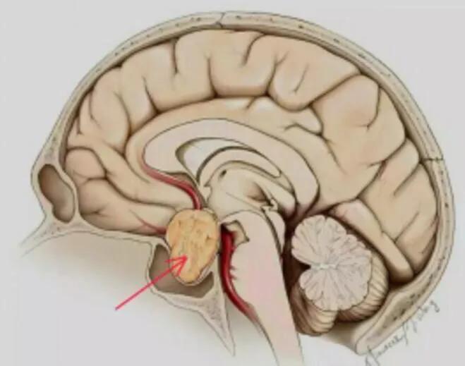 姨妈晚走一般因为什么,每个月大姨妈都来9天怎么回事