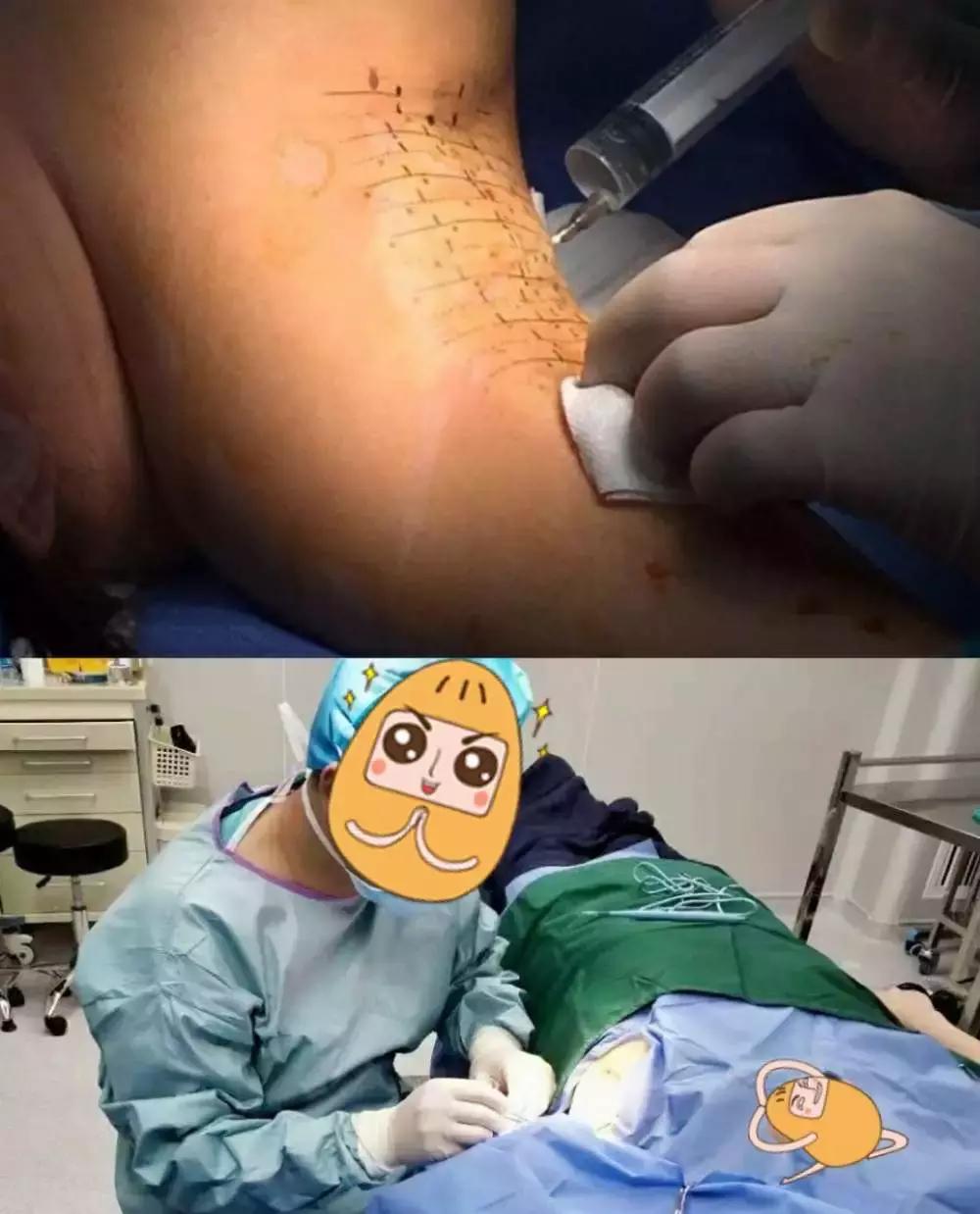 人一般有腋臭正常吗,很多人有狐臭吗