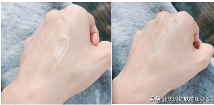 眼周围松弛有皱纹怎么办,眼睛部位皮肤松弛怎么保养