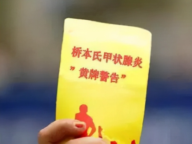 哪些人容易中桥本氏甲状腺炎的招？