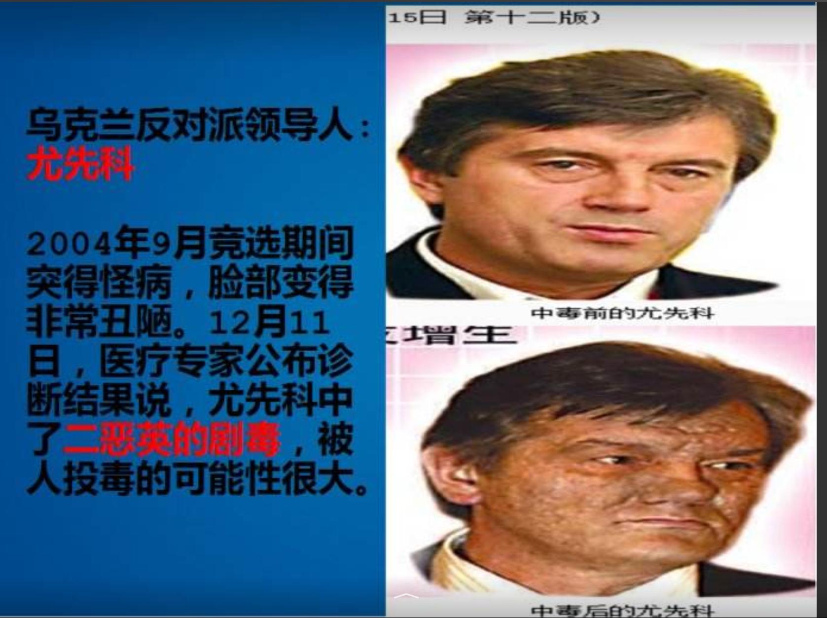 二恶英的来源及危害,二恶英超标正常吗