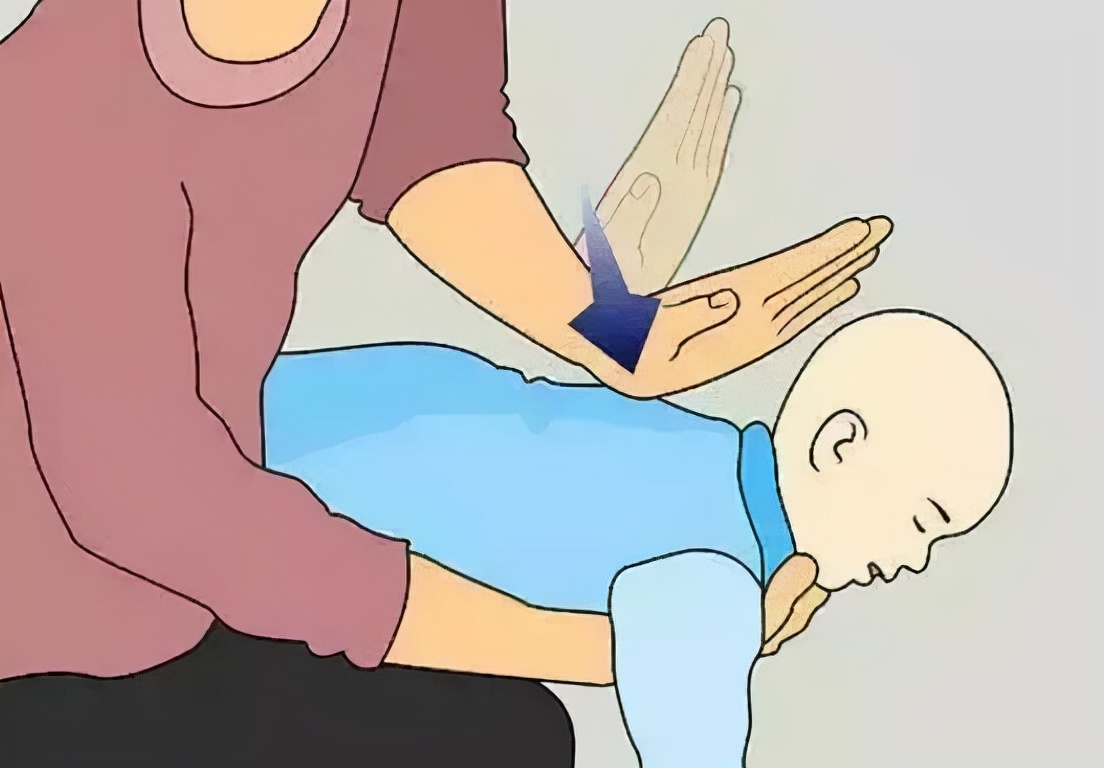 婴儿异物卡住喉咙案例,宝宝咽鱼刺卡住的状态