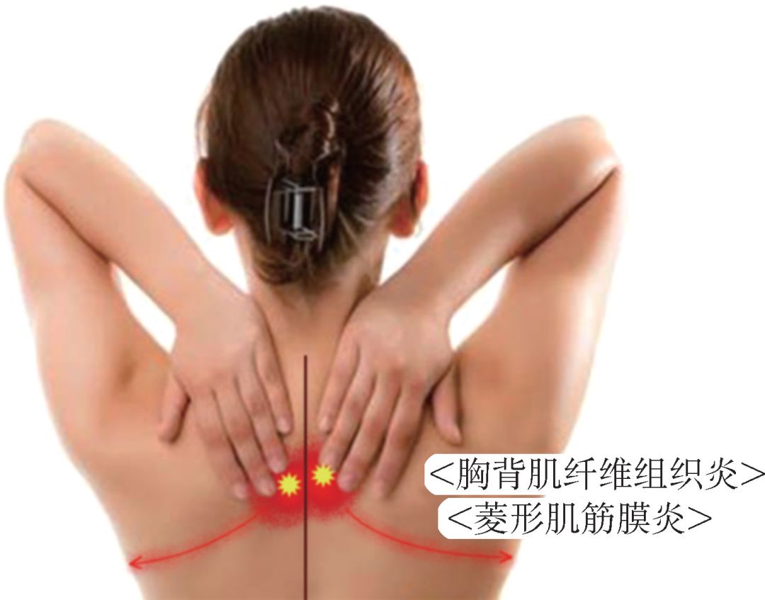 肌肉与关节疼痛的原因,关节周围肌肉疼痛