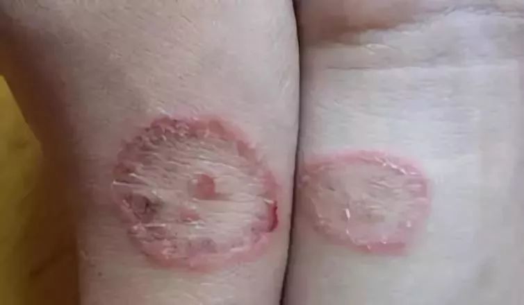 两个女孩合租一个房间得病,两个女生合租一个房子得病