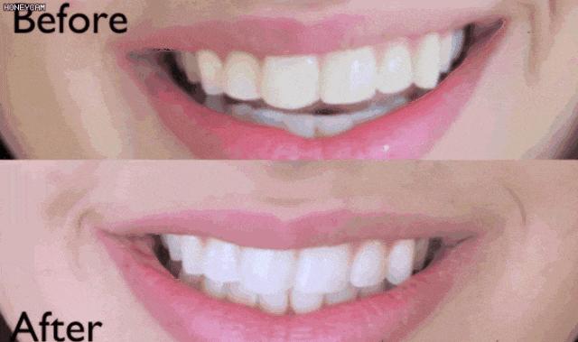 十大美白牙齿牙膏,美白去渍牙膏澳洲