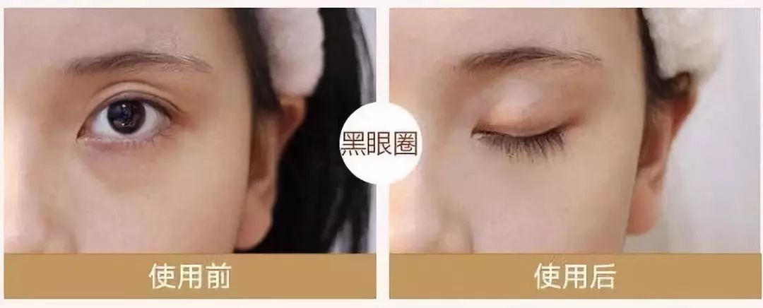 马应龙八宝眼袋型眼膜,马应龙八宝多肽眼膜