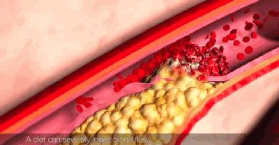 健康平安生孩子需要注意什么,生孩子是剖宫产比较痛还是顺产痛