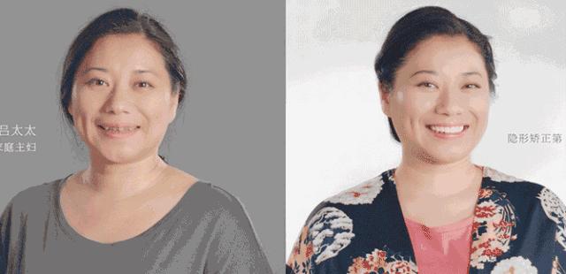 速看！11月起，这些新规实施，矫正牙齿、种植牙这些费用全免！