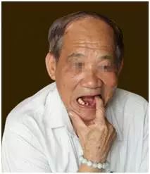 矫正牙齿不给报销吗,牙齿矫正为什么不能纳入医保