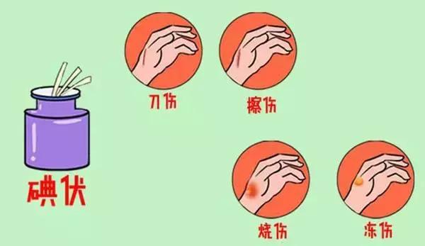 紫药水处理伤口有多痛,酒精和碘伏哪个处理伤口比较好