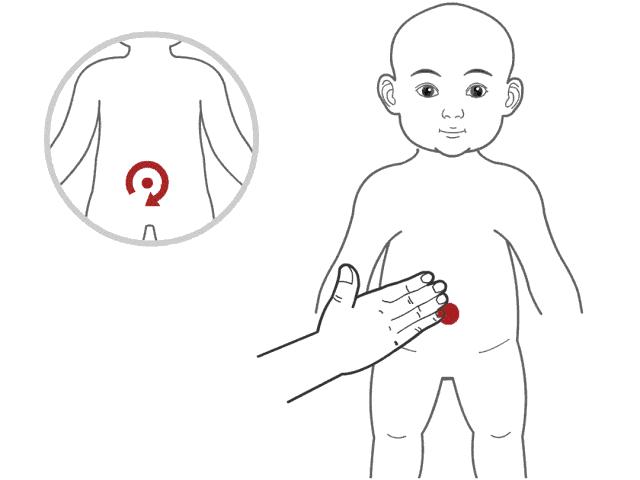 小儿夜间磨牙推拿手法,儿童晚上睡觉磨牙怎么推拿