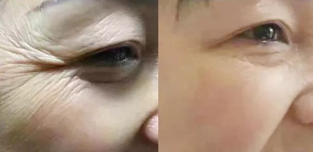 蒸汽抗疲劳缓解黑眼圈眼罩,泰国草本蒸汽眼罩