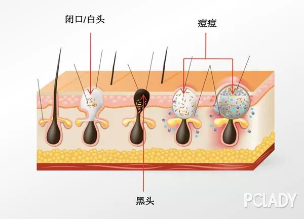 vc缇庣櫧鐖借偆姘村幓闂彛,钖忎粊姘磋姦鑽熻兌