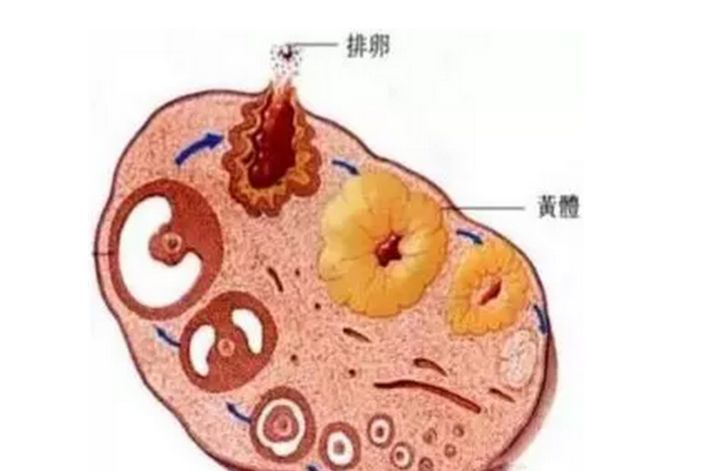 卵巢破裂女性,卵巢破裂急救处理