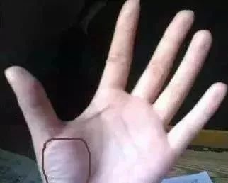 手上这块肉一看就知身体好不好,手掌上这块肉身体问题一看就知道