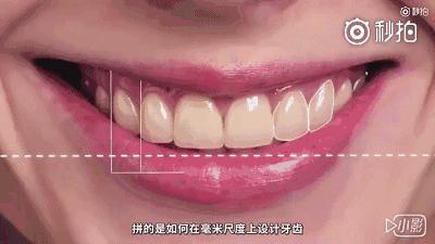 武汉种植牙齿需要多少钱,武汉种植牙齿一颗要多少钱