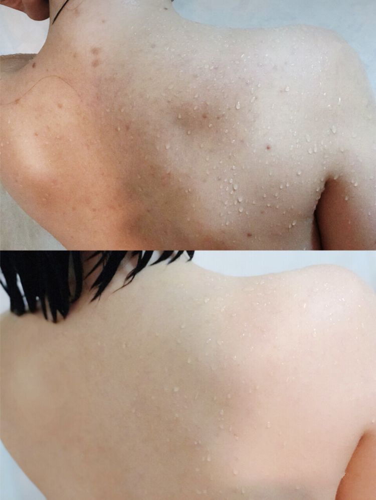 肉眼可见的除螨效果，日本爆款除螨贴，24小时不间断，除螨率高达97%