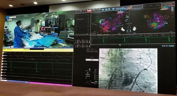 「房颤专项能力培训第10期」浙江大学邵逸夫医院站：导管消融、安全倍增齐头并进