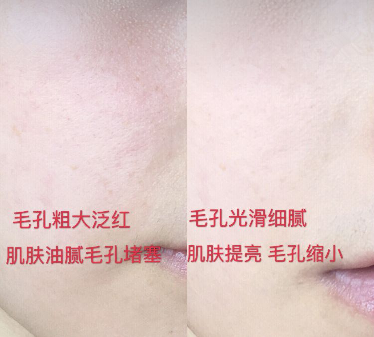 luna平价替代品,平价版的luna