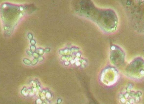 被污染的细胞,污染的细胞怎么处理