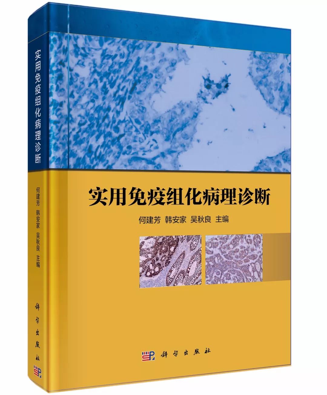 病理检查后建议做免疫组化,免疫组化病理检测需要几天