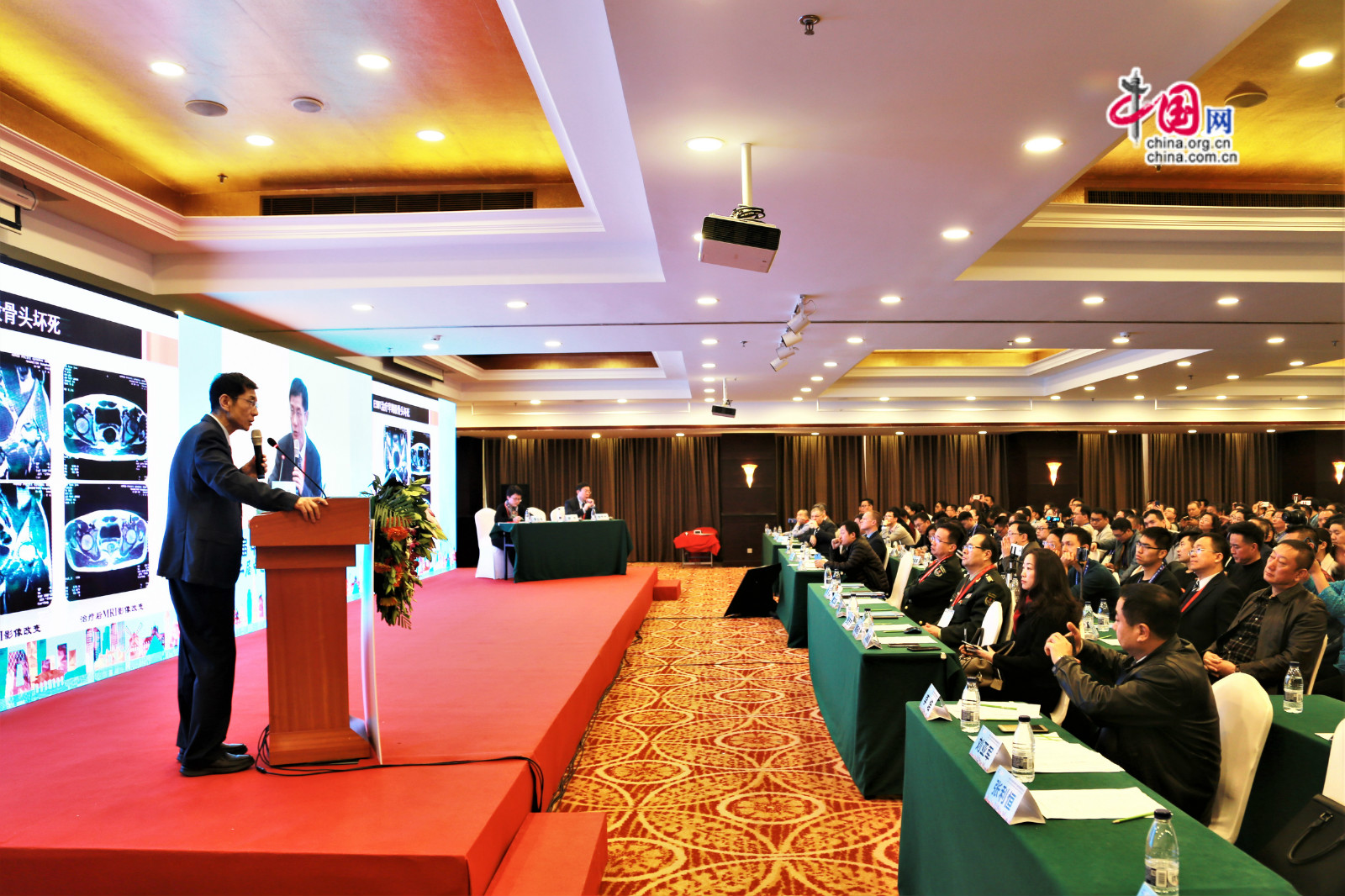 冲击波治疗医保,邢更彦医师