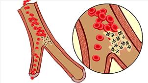 打针输液时空气进入了血管，我是不是要死了？