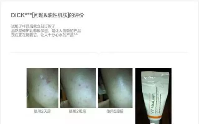 一支“激光霜”帮你解决众多困扰~