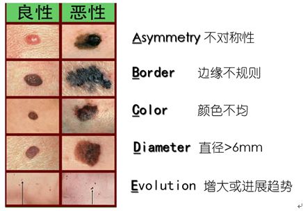 你说不“痣”道的事！
