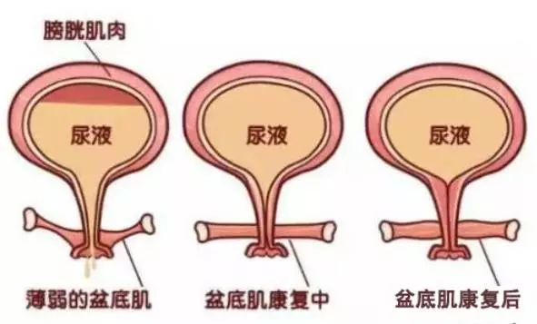 那些妈妈们不知道的产后“尴尬事”