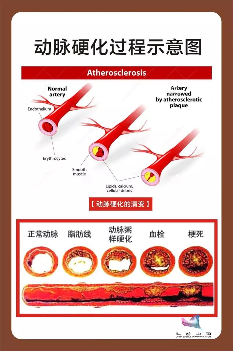 健康摄入盐量,健康饮食少油少盐会怎么样
